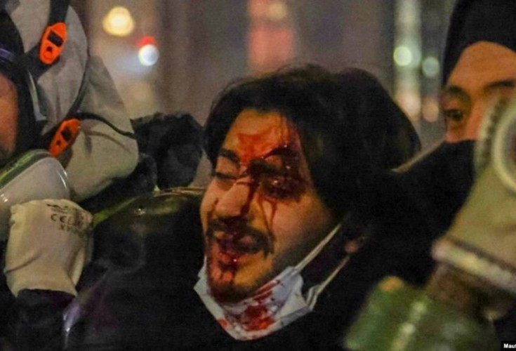 ალექსანდრე თირქიას დაშავებიდან  1 წელი გავიდა, თუმცა პასუხისმგებელი პირები დღემდე არ გამოვლენილან